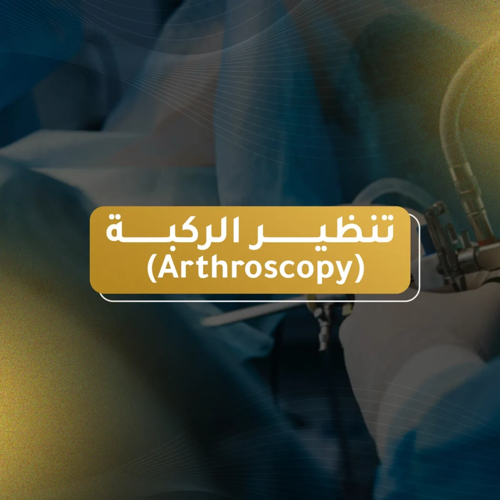 تنظير الركبة (Arthroscopy)