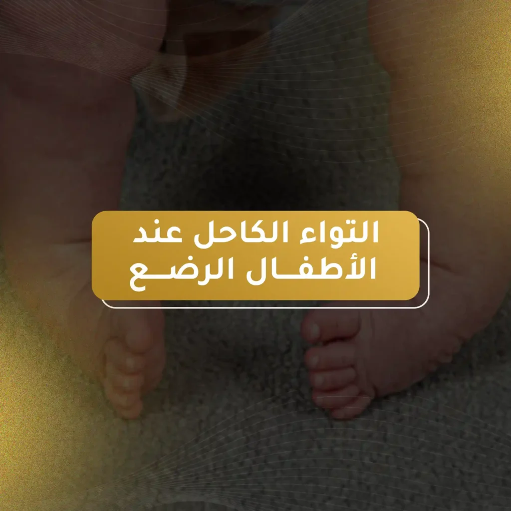 التواء الكاحل عند الأطفال الرضع