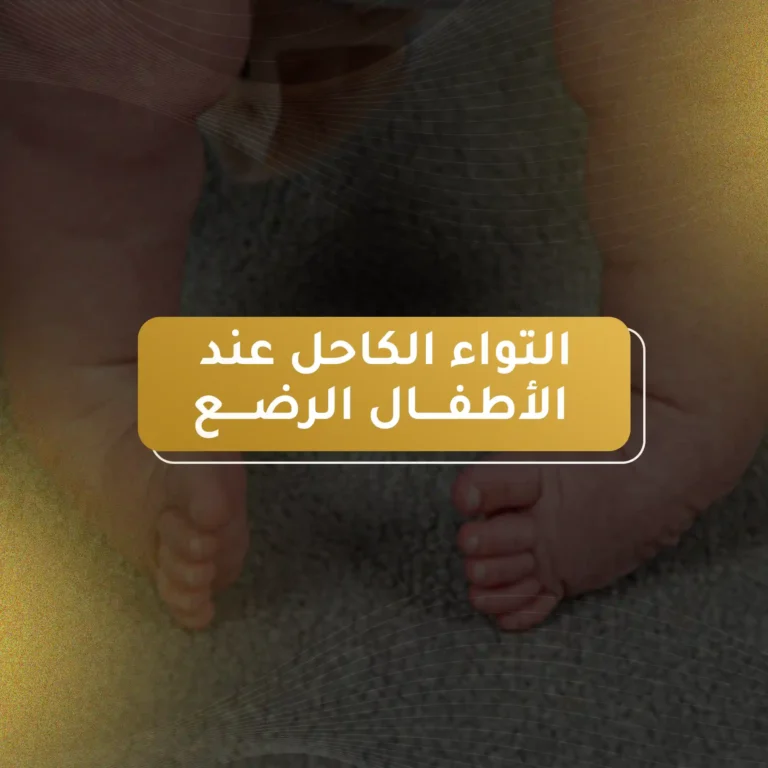 التواء الكاحل عند الأطفال الرضع