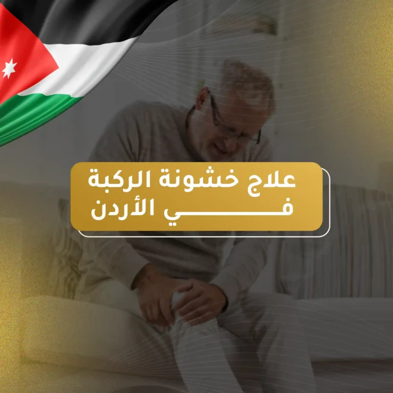 علاج خشونة الركبة في الاردن