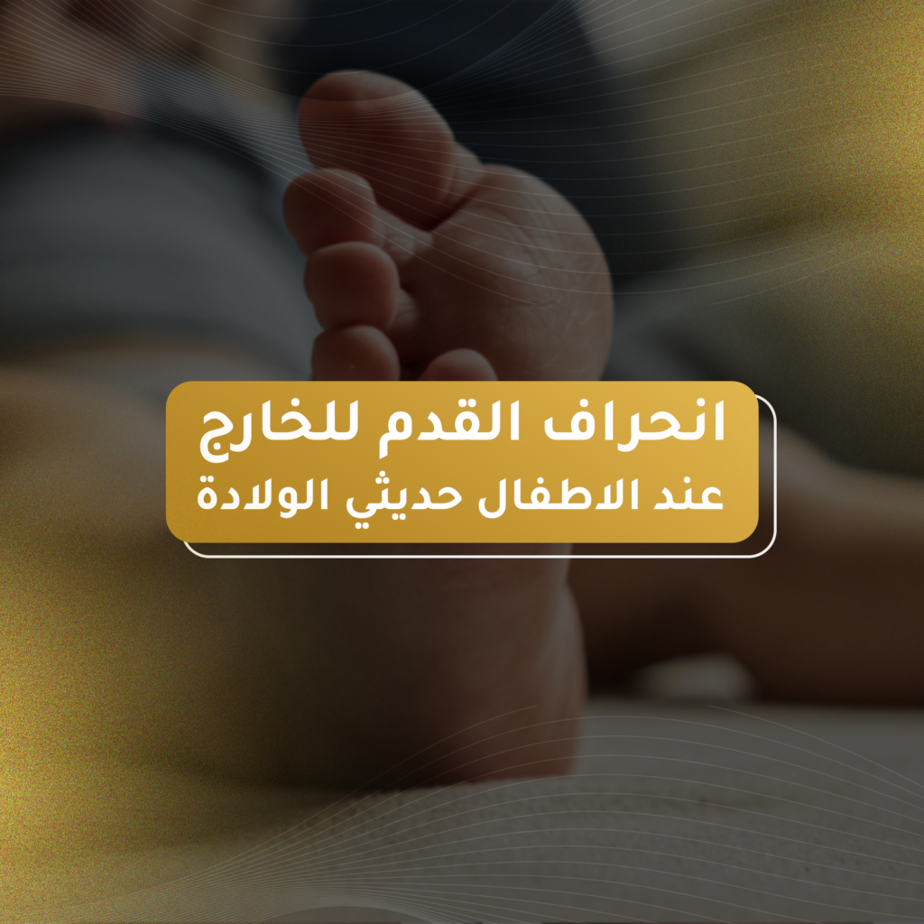 انحراف القدم للخارج عند الاطفال حديثي الولادة