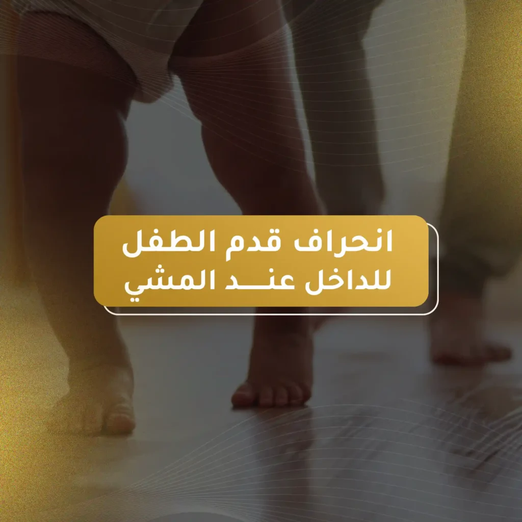 انحراف قدم الطفل للداخل عند المشي