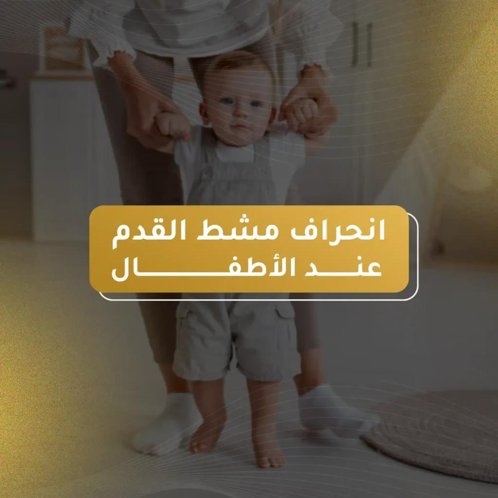 علاج انحراف مشط القدم عند الاطفال