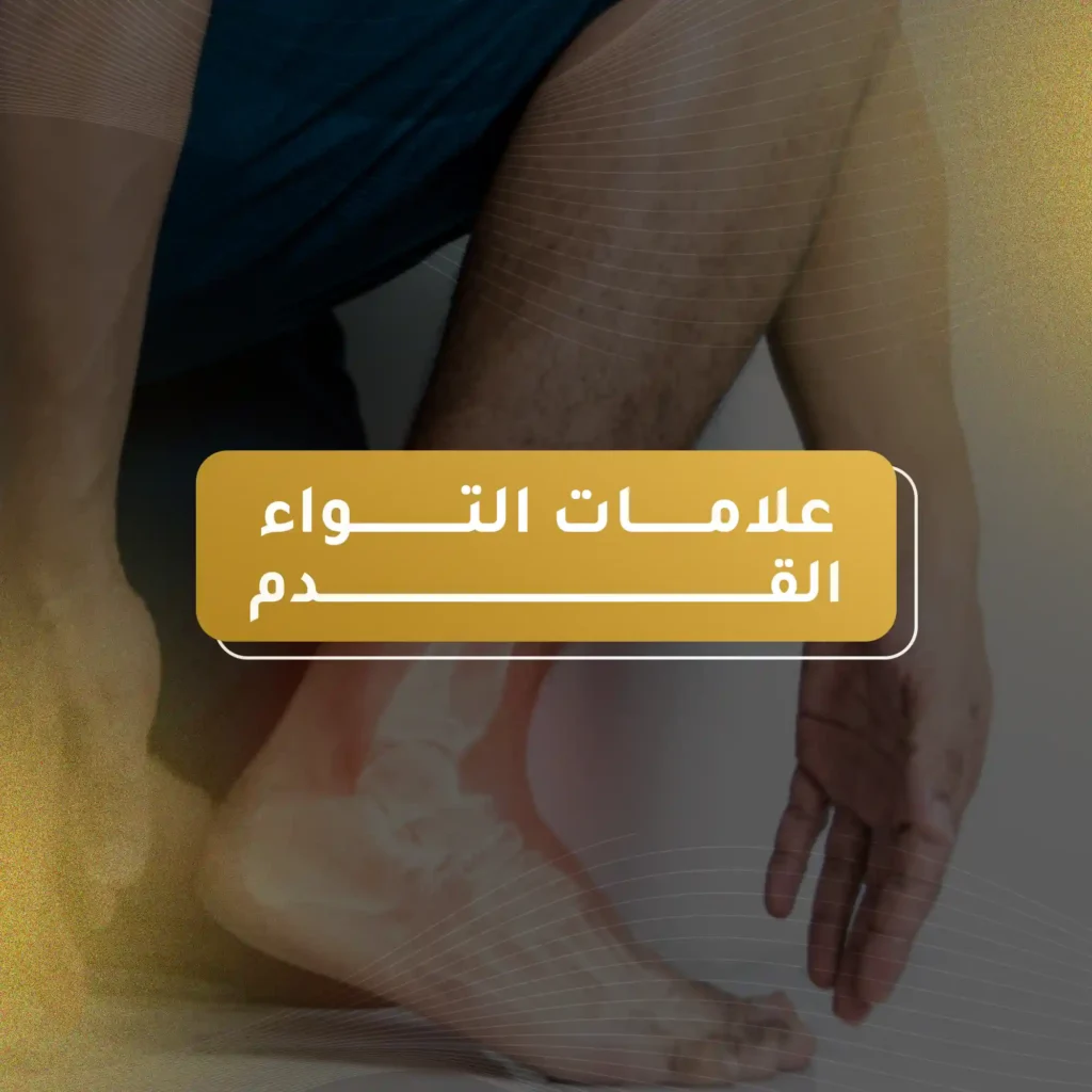 إليك أهم علامات التواء القدم مع الدكتور احمد القاسم 2025