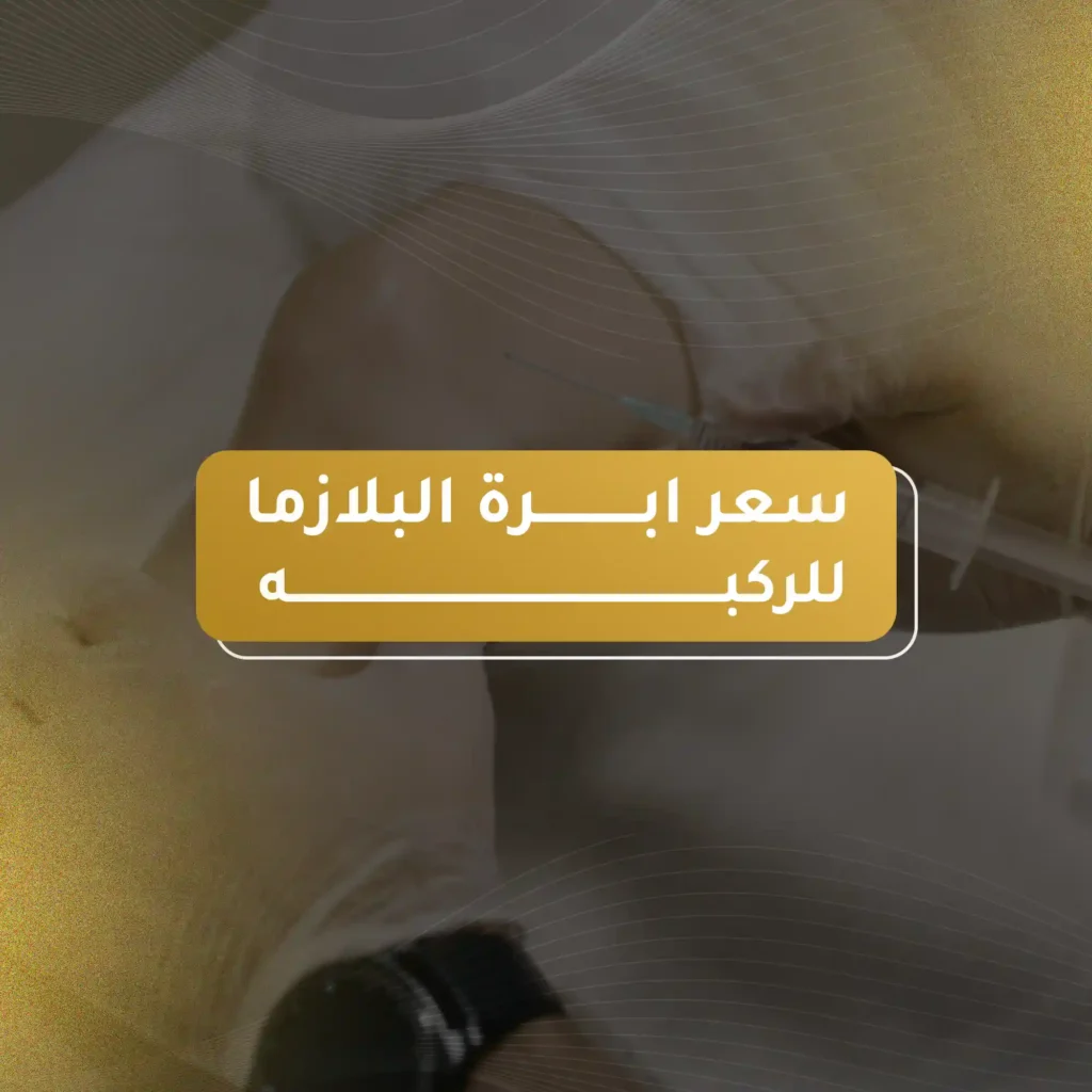 سعر ابرة البلازما للركبه