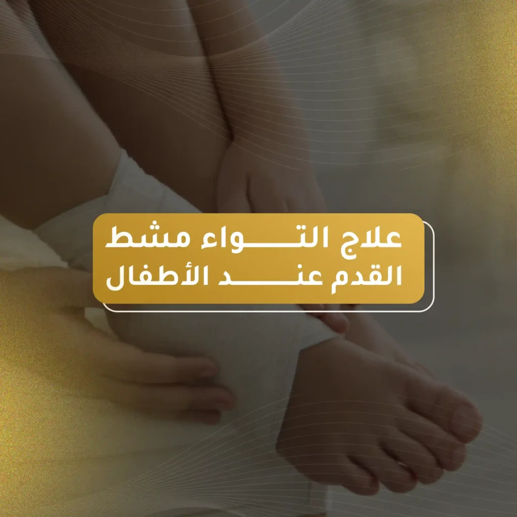 علاج التواء مشط القدم عند الاطفال
