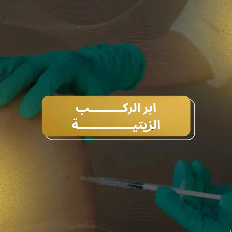 ابر الركب الزيتية