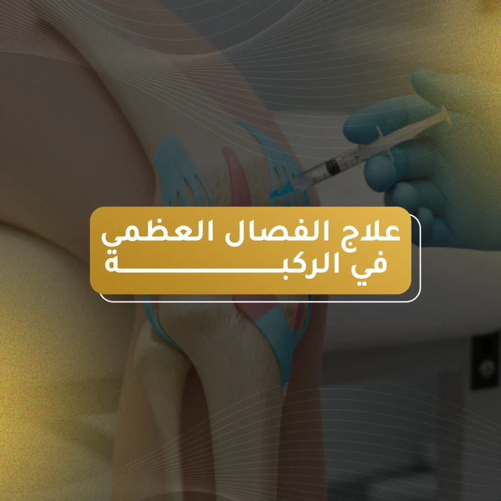 علاج الفصال العظمي في الركبة