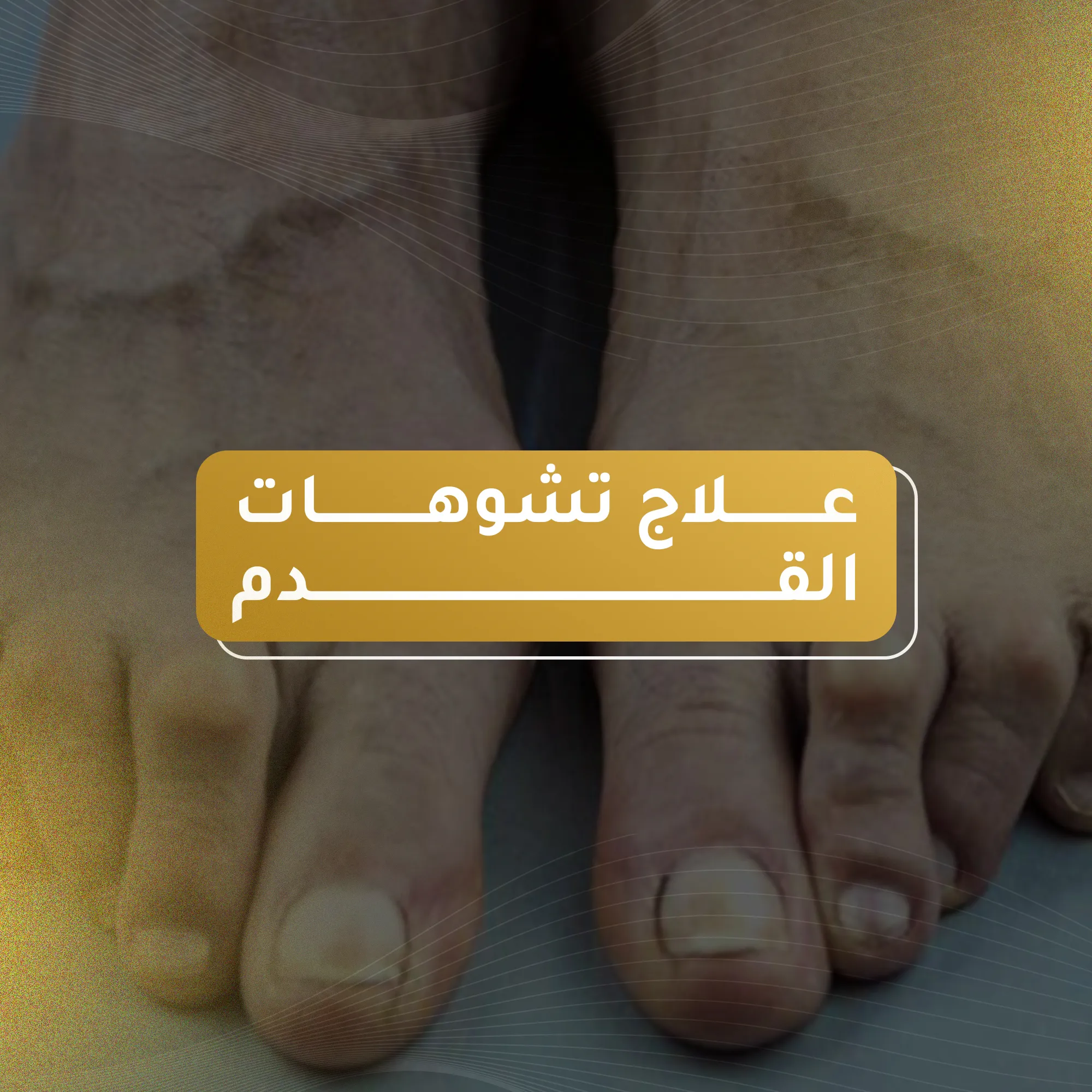 علاج تشوهات القدم