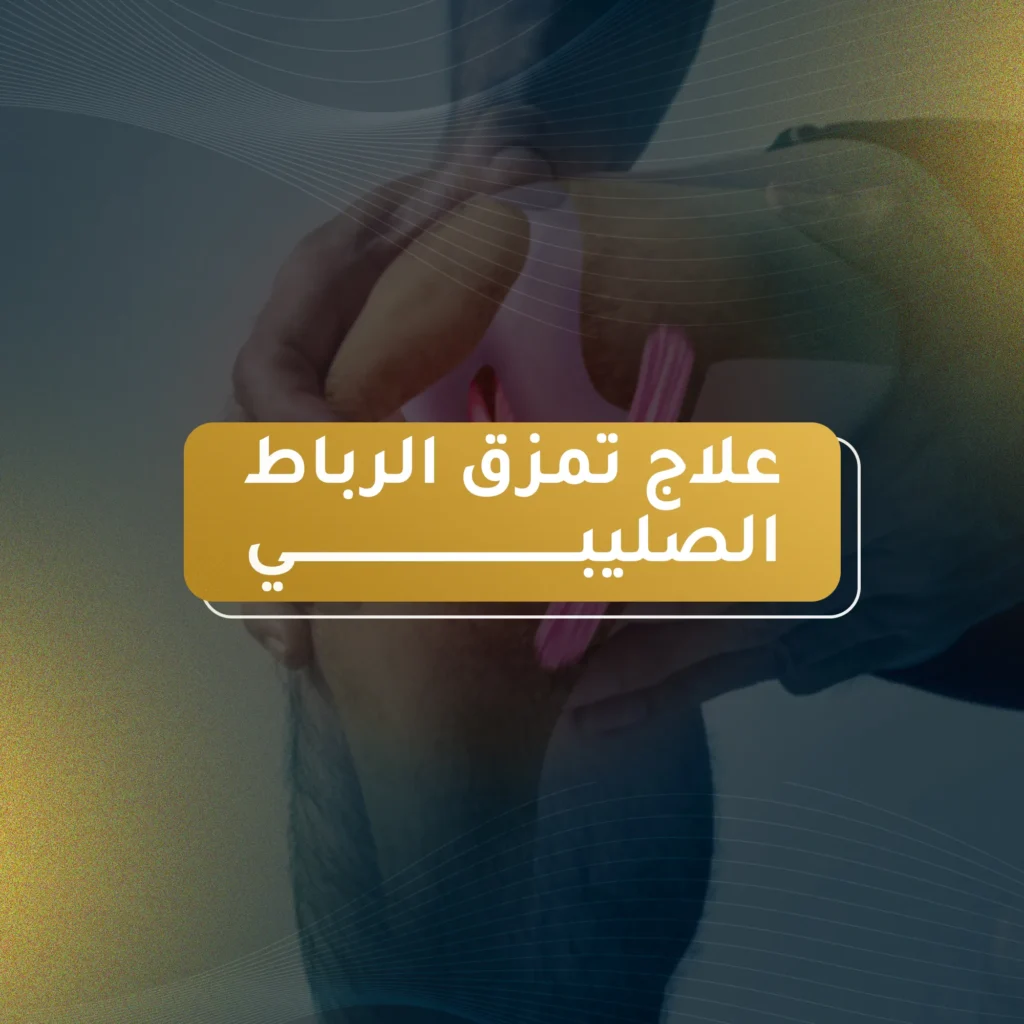 علاج تمزق الرباط الصليبي