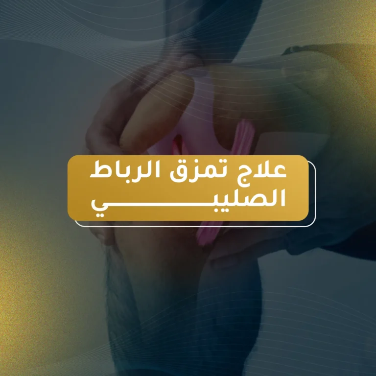 علاج تمزق الرباط الصليبي
