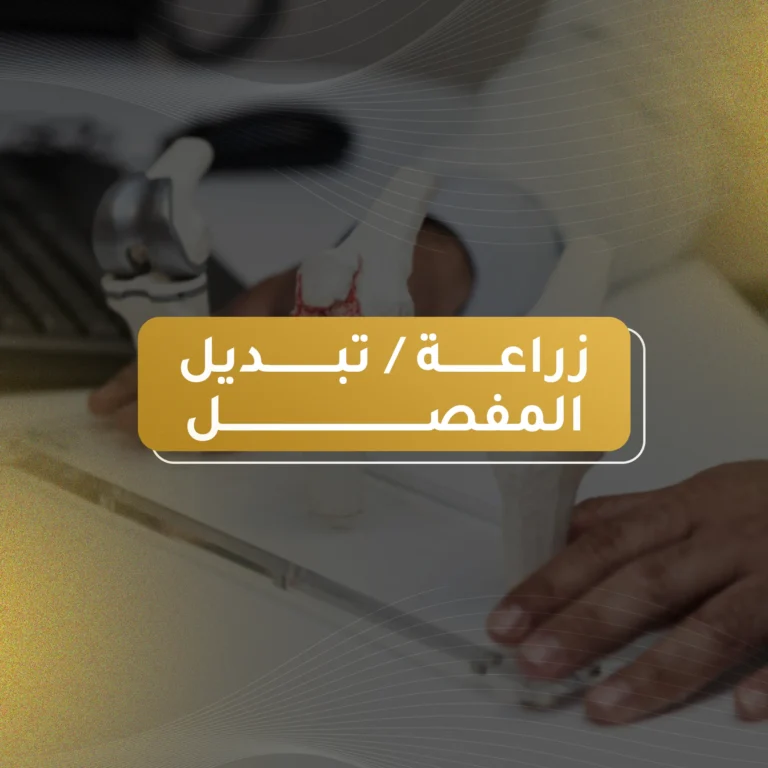 عملية زراعة تبديل المفصل