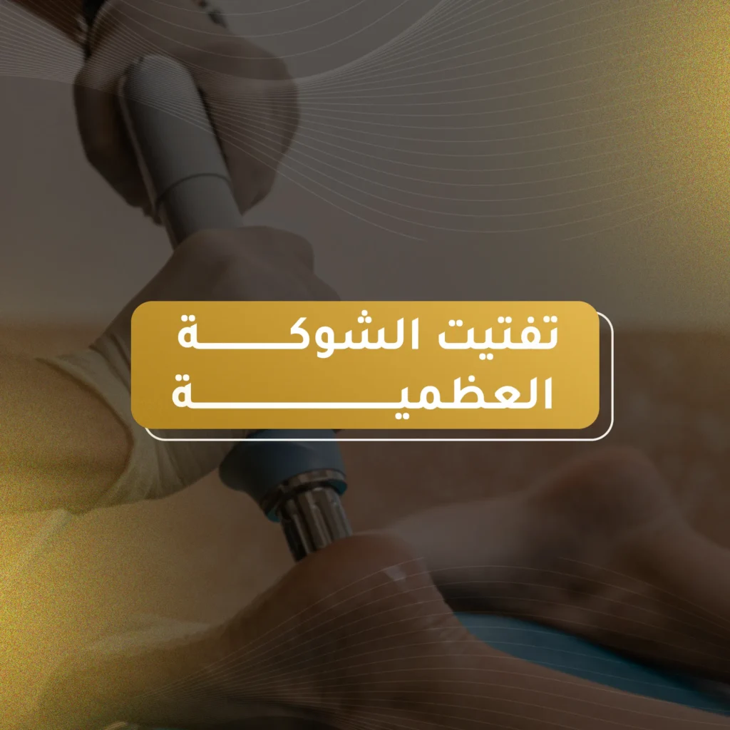 افضل دكتور تفتيت الشوكة العظمية في الأردن