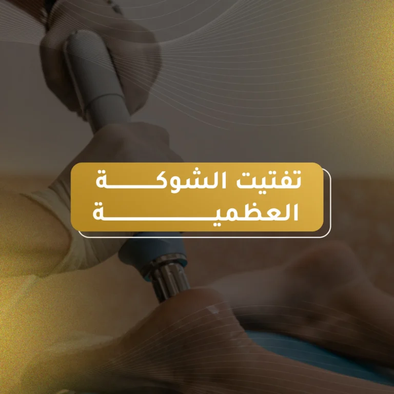 افضل دكتور تفتيت الشوكة العظمية في الأردن