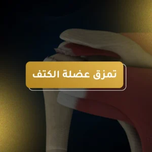 افضل دكتور تمزق عضلة الكتف في الأردن