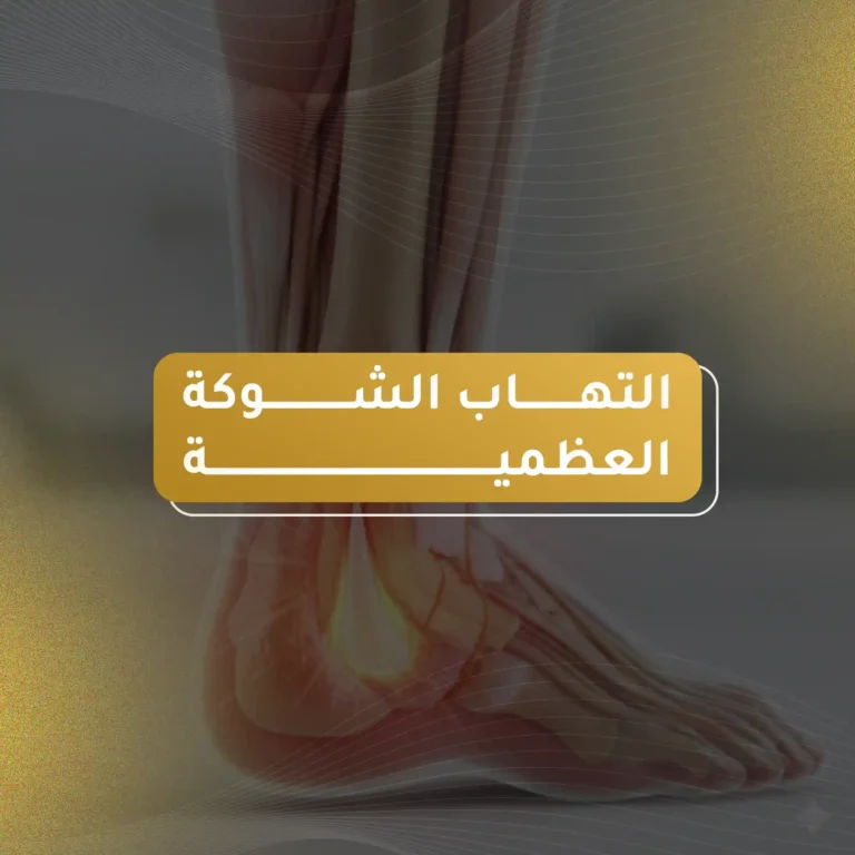 التهاب الشوكة العظمية