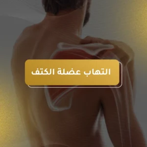 التهاب عضلة الكتف