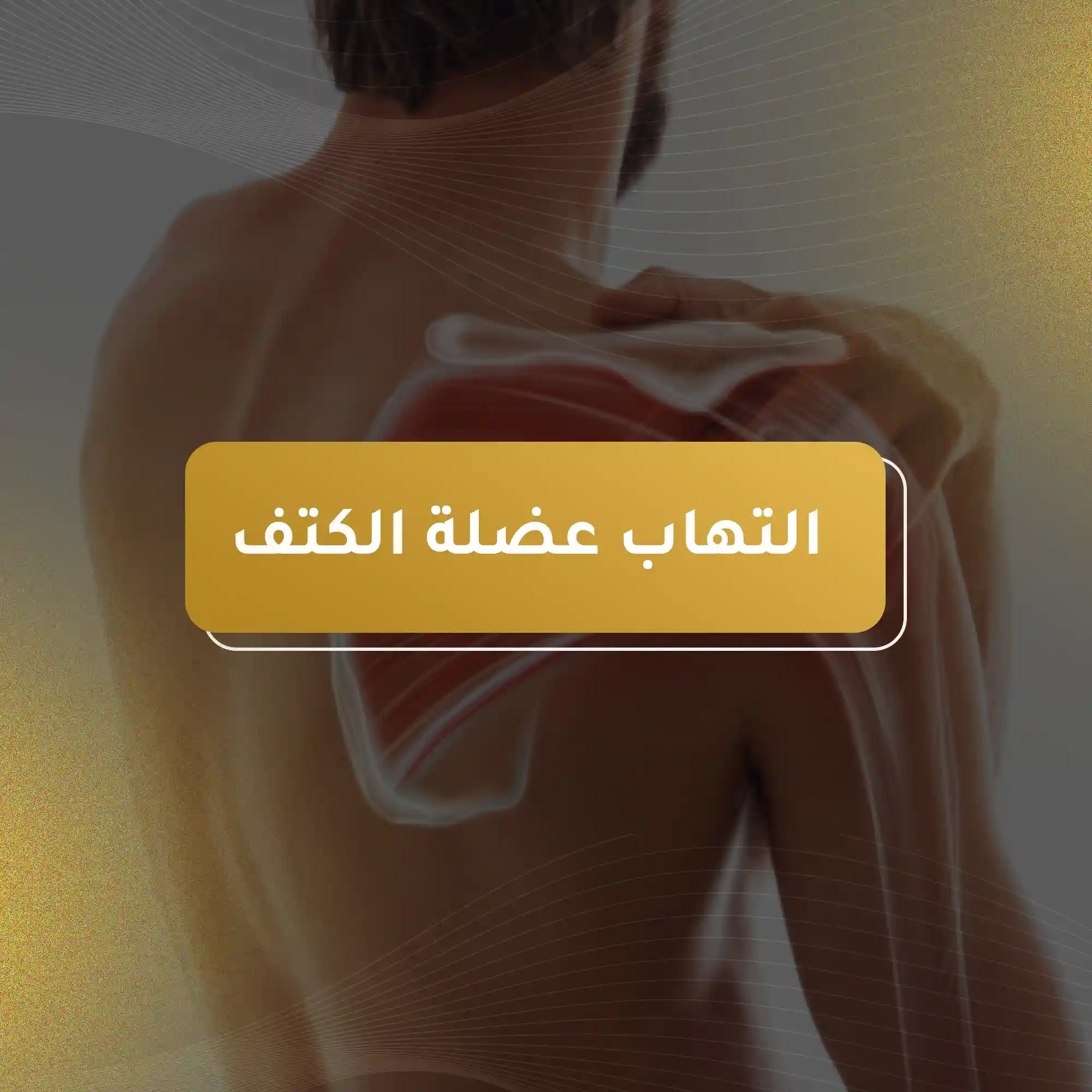 التهاب عضلة الكتف