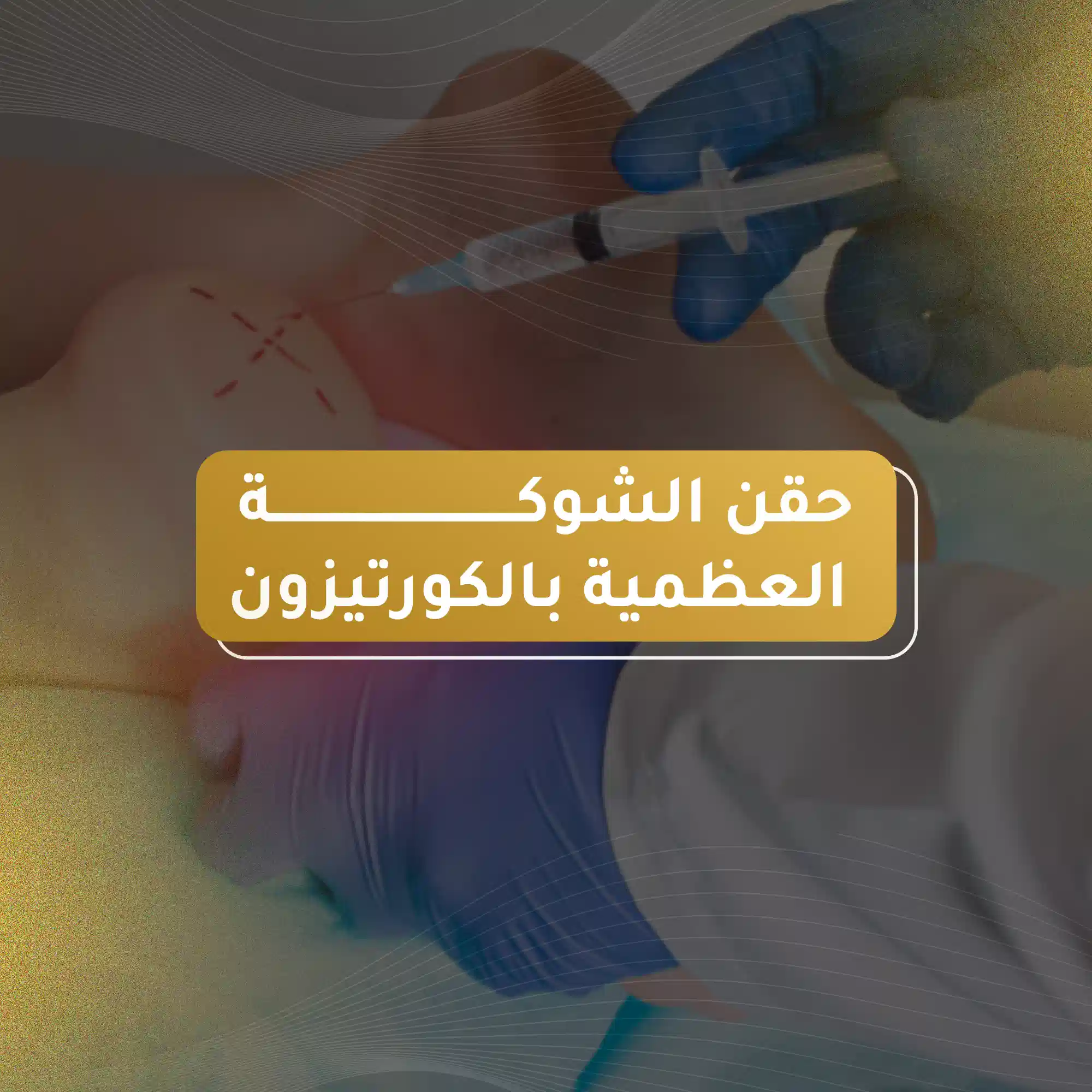 حقن الشوكة العظمية بالكورتيزون